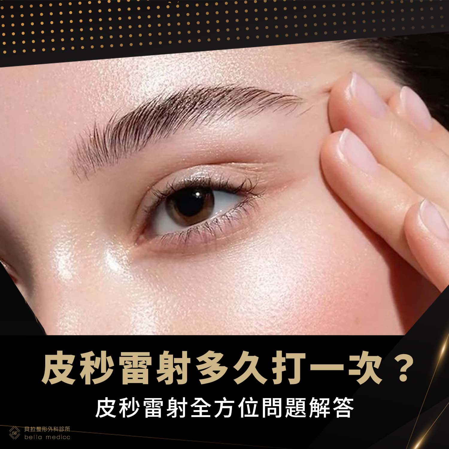 皮秒雷射多久打一次